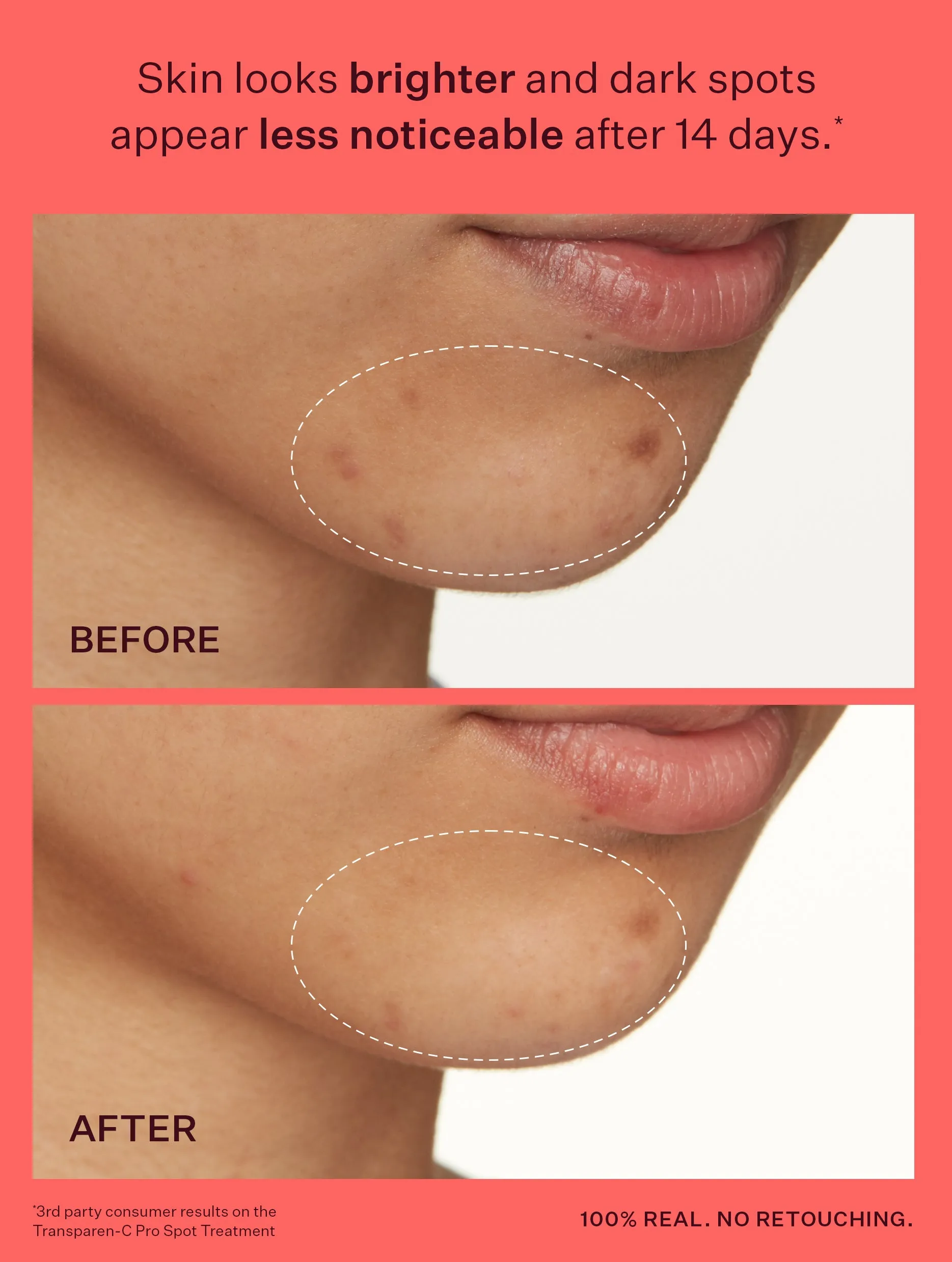 Transparen-C Pro Brightening Duo