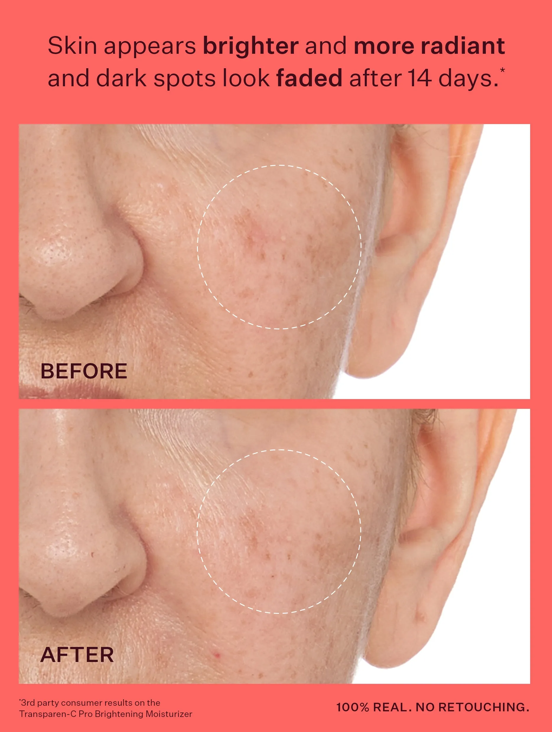 Transparen-C Pro Brightening Duo